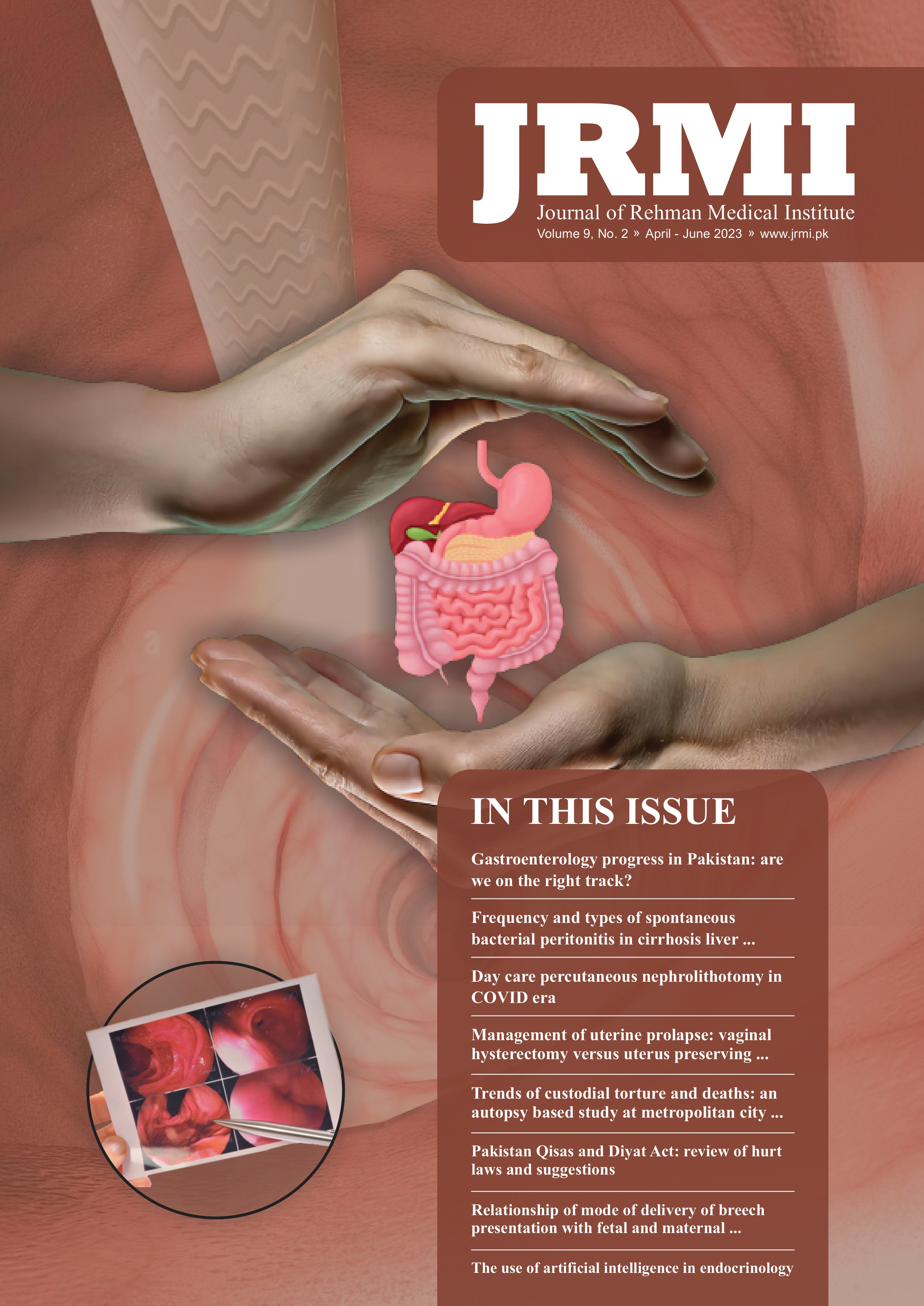 					View Vol. 9 No. 2 (2023): Journal of Rehman Medical Institute
				
